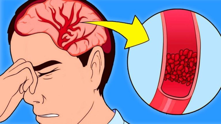 Questo metodo semplice rivela 7 segnali allarmanti del tuo sangue…