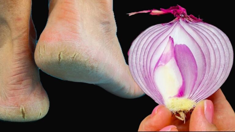 Questo semplice gesto trasforma i tuoi piedi rudi in meraviglie senza crepe…