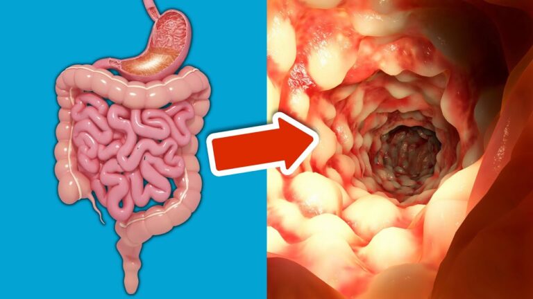 Scopri 1 semplice bevanda che pulisce il tuo intestino in modo sorprendente!