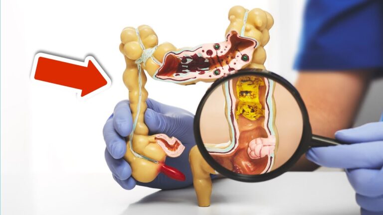 5 modi infallibili per mantenere il tuo intestino sano e felice!