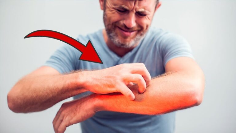 Scopri 5 segni del diabete che non puoi ignorare per stare bene!