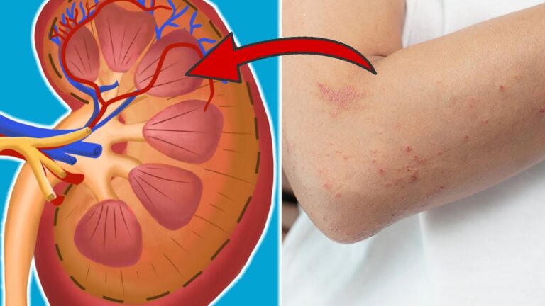 7 segnali che le tue reni hanno bisogno di aiuto: scopri quali!