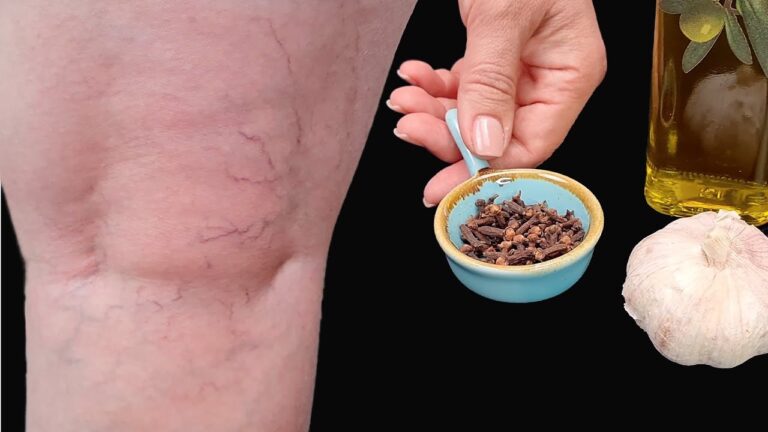 Scopri 5 rimedi naturali per alleviare i dolori articolari e muoversi meglio!
