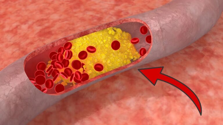 9 cibi sorprendenti per pulire le arterie e migliorare la salute!
